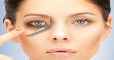 الهالات السوداء: وداعًا للكونسيلر بوصفات طبيعية تفتح عينيكِ من جديد