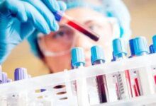 علاج прост намиране на проста и бърза алтернатива на лекарствата за диабет тип 2, които лесно се намират в аптеките.