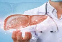 السكر والكبد: طبيب يوضح كيف يدمر استهلاك الحلوى صحتك تدريجيًا