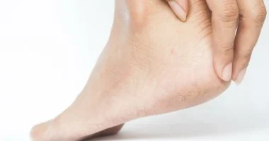 الكالو المزعج؟ هكذا تتخلص من آلامه وتقضي على الجلد المتصلب بوصفات طبيعية فعالة