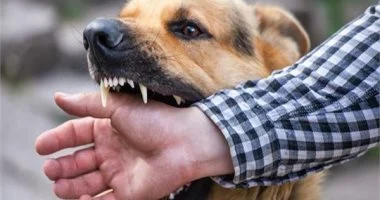 "عضة كلب قاتلة في الهند: طفلة تتلقى التطعيم وتفارق الحياة.. الأطباء يكشفون السبب"