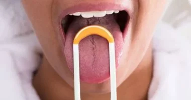 لماذا تظهر الحبوب على اللسان؟ 10 أسباب قد تجهلها