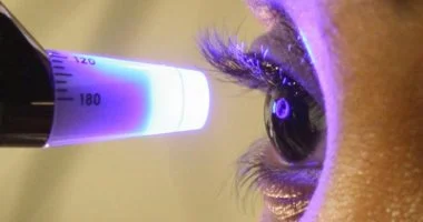 الجلوكوما تسرق البصر تدريجيًا: أطباء يكشفون العلامات المبكرة وخطورتها كـ"لص صامت"